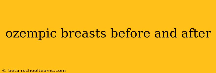 ozempic breasts before and after