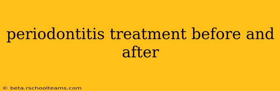 periodontitis treatment before and after