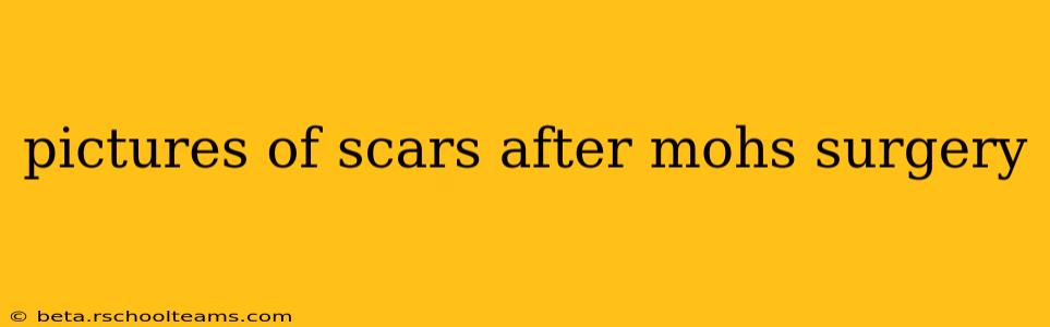 pictures of scars after mohs surgery