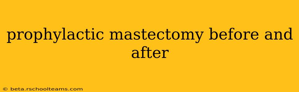 prophylactic mastectomy before and after