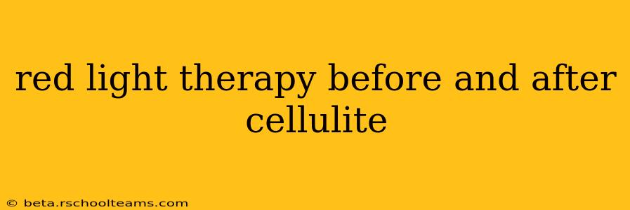 red light therapy before and after cellulite