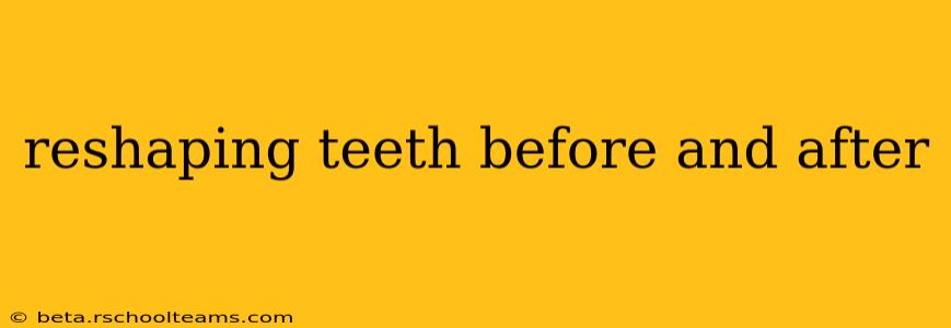 reshaping teeth before and after