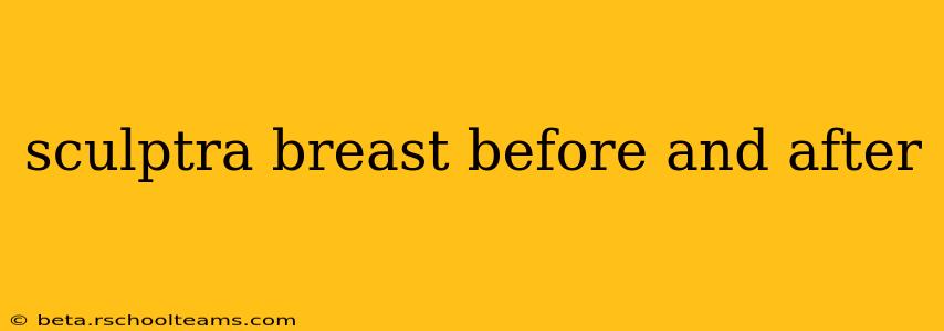 sculptra breast before and after