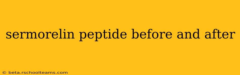 sermorelin peptide before and after