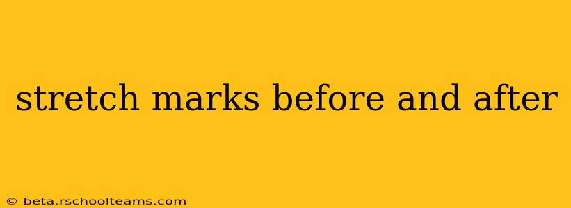 stretch marks before and after