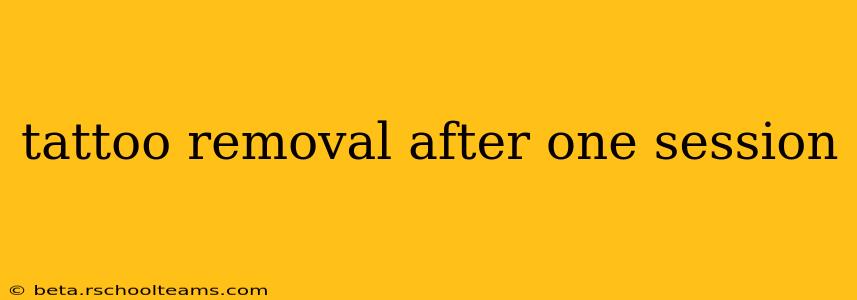 tattoo removal after one session
