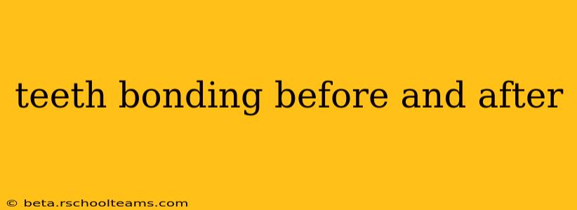 teeth bonding before and after