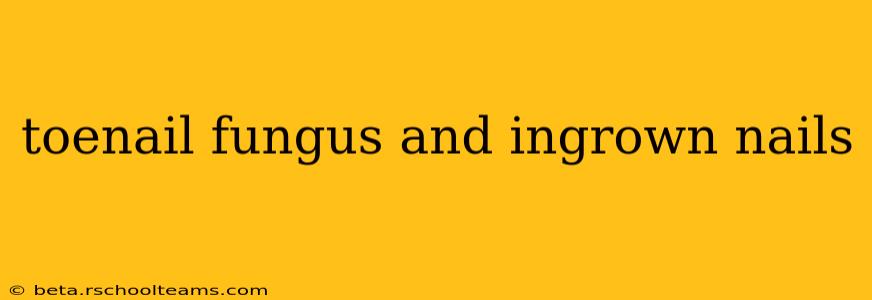 toenail fungus and ingrown nails