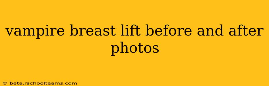 vampire breast lift before and after photos