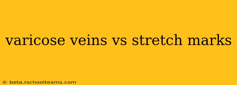 varicose veins vs stretch marks