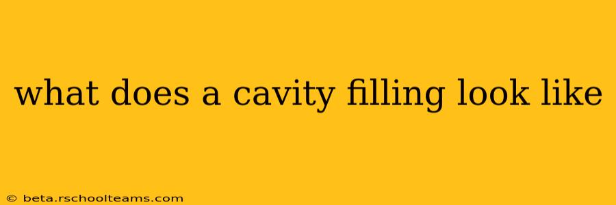 what does a cavity filling look like