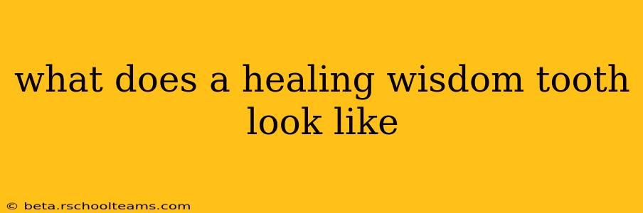 what does a healing wisdom tooth look like