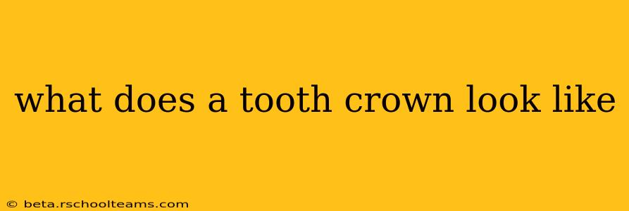 what does a tooth crown look like