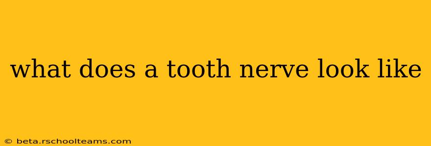 what does a tooth nerve look like