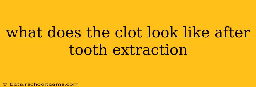 what does the clot look like after tooth extraction