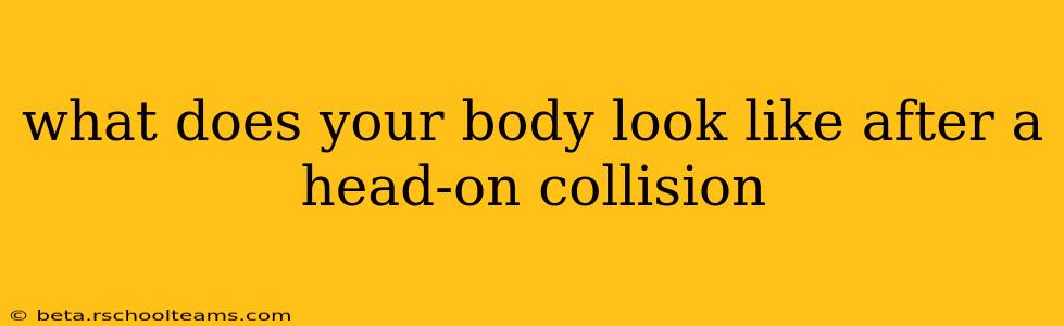 what does your body look like after a head-on collision