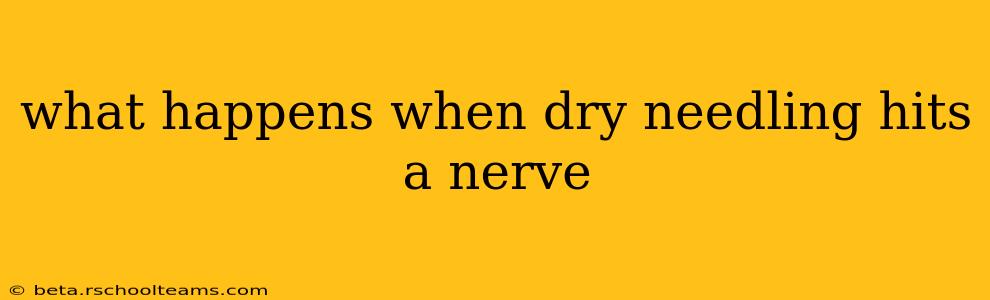 what happens when dry needling hits a nerve