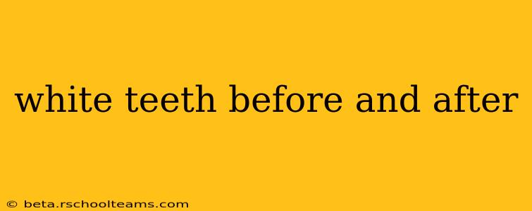 white teeth before and after
