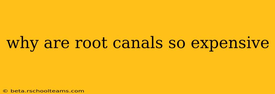 why are root canals so expensive