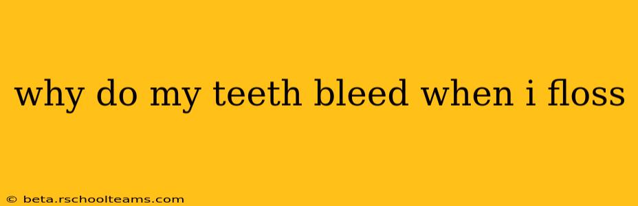 why do my teeth bleed when i floss