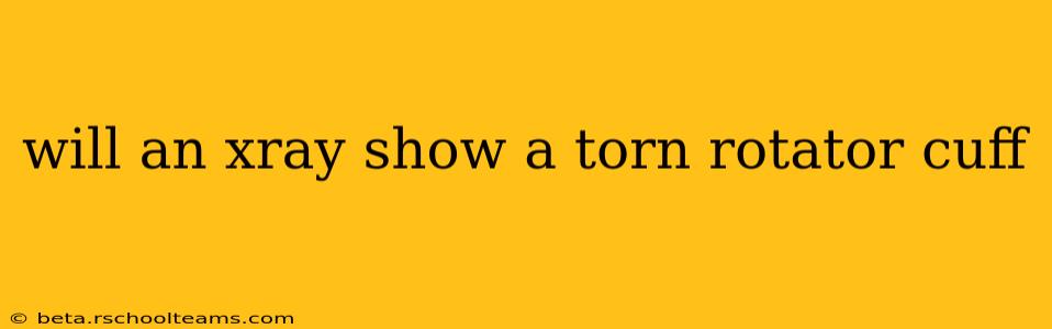 will an xray show a torn rotator cuff