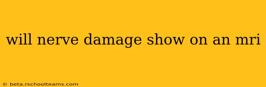 will nerve damage show on an mri